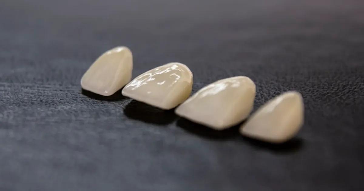 Problemas con Uñas Acrílicas: Prevención, Mantenimiento y Soluciones Profesionales