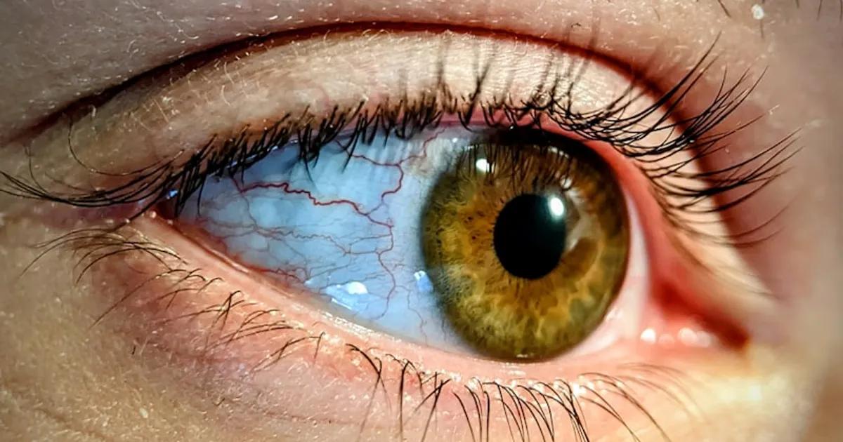 Lifting de Pestañas vs Extensiones: Diferencias Clave para Elegir el Mejor Resultado