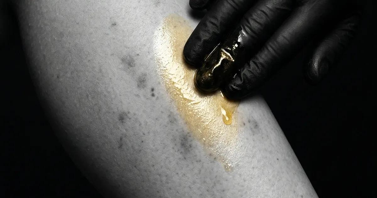 Manchas Oscuras Después de Depilación con Cera: Causas y Tratamiento