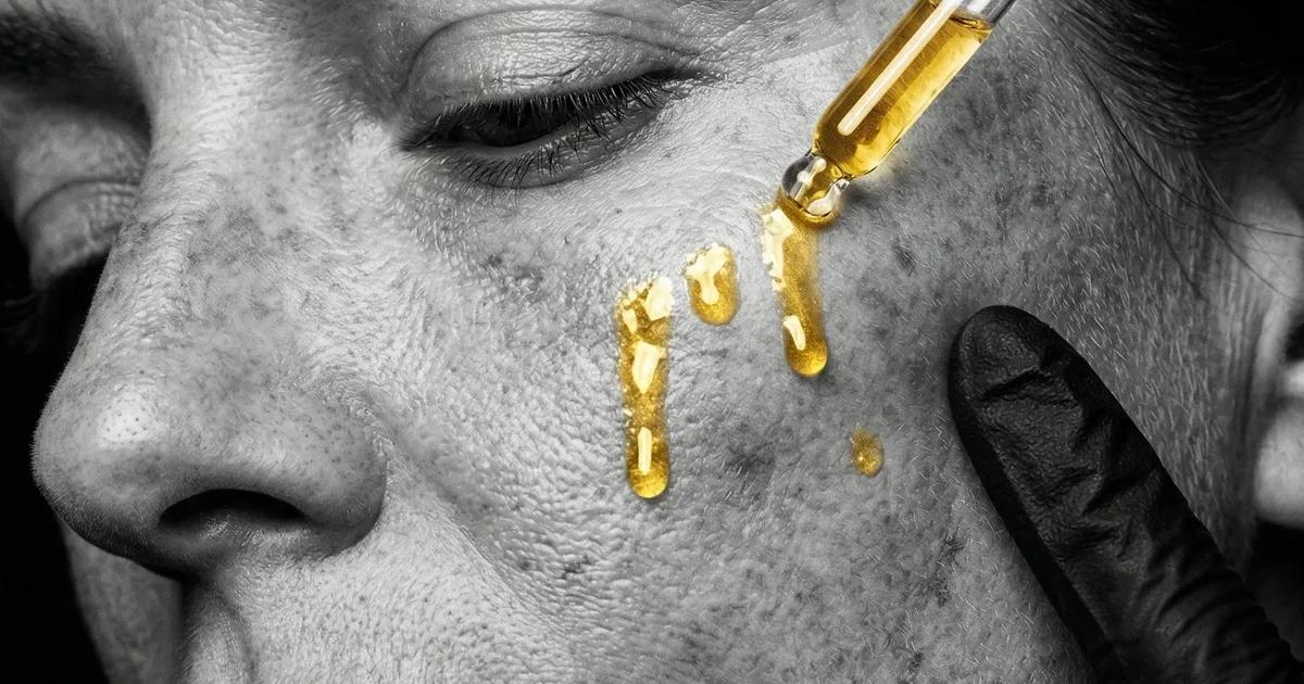 reparar piel después verano septiembre — tratamientos-faciales en Adrian Beauty Studio