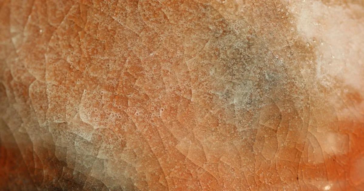 Vello Encarnado Después de Depilación: Cómo Prevenirlo y Tratarlo Profesionalmente